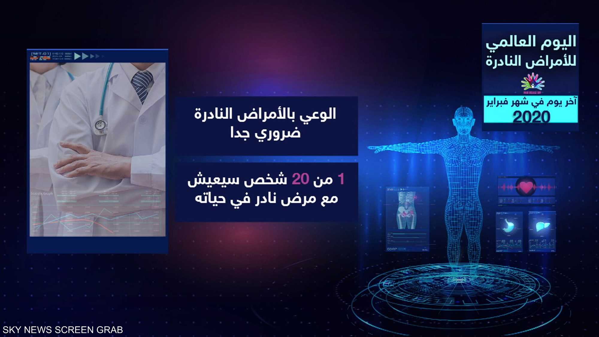 الأمراض النادرة