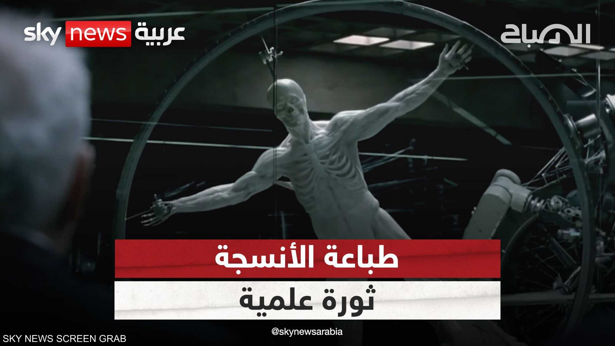 الطباعة ثلاثية الأبعاد: ثورة في عالم الطب بقيادة سودانية