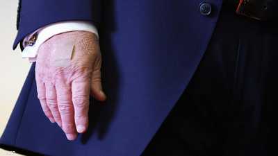 تساؤلات بشأن صحة ترامب.. "اليد اليسرى" تثير جدلا