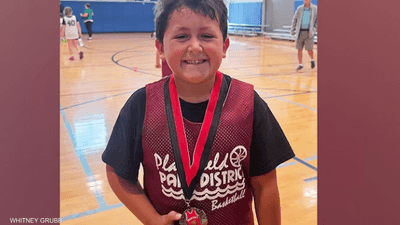 نفذ تحديا على تيك توك.. لعبة تنفجر في وجه طفل وتصيبه بحروق