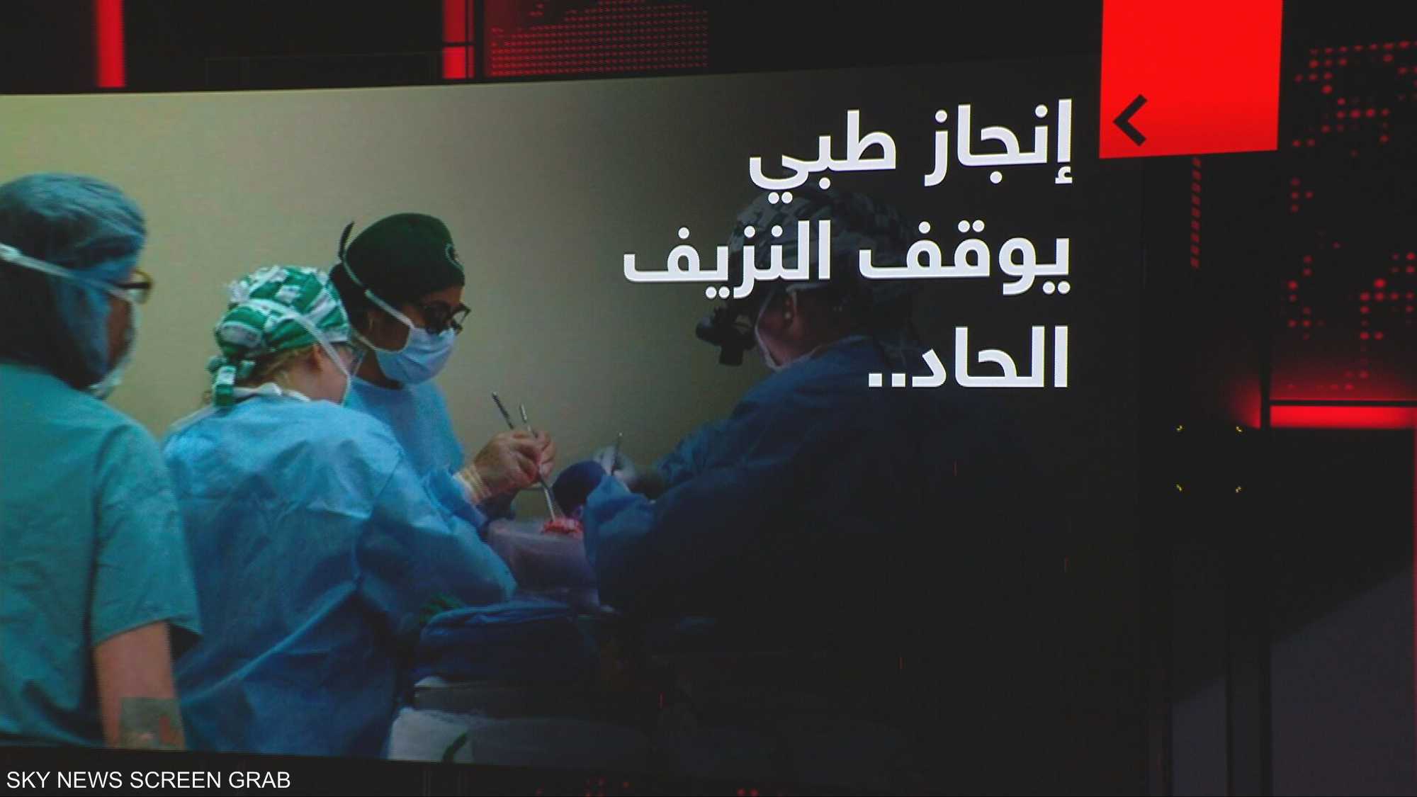 إنجاز طبي يوقف النزيف الحاد